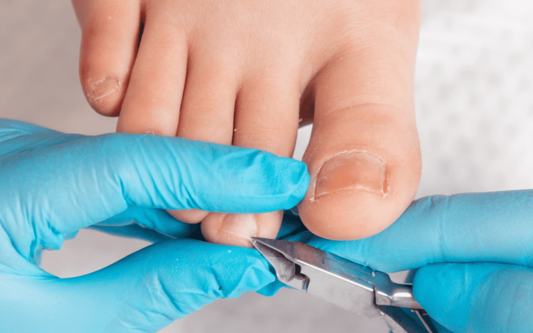 Taking the Right Steps: The Importance of Foot Care and Professional Nail Trimming Services